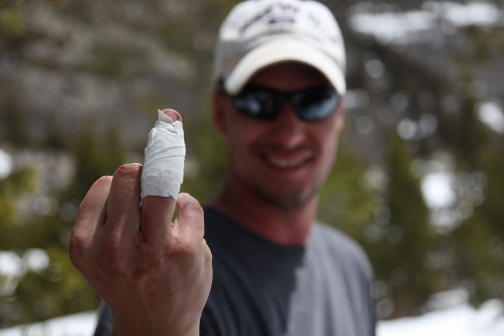Dale fell and busted up his finger.  We created a bandage with gauze and athletic tape.